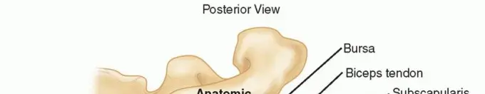 صورة توضيحية لـ علاج عدم استقرار الكتف مع فقدان العظم: دليل شامل لاستعادة حركتك وحياتك الطبيعية في اليمن