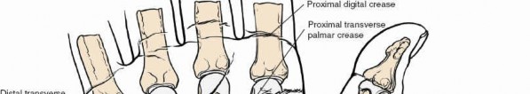 Illustration 36 for Volar Wrist Surgery: Master the Anatomy of the tendon of the flexor