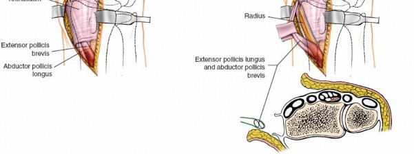 Illustration 20 for Essential Surgical Approaches: Uncover Every Aspect of the Wrist