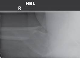 Illustration 11 for Ace Your FRCS: Key Questions in Trauma & Orthopaedics