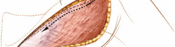 Illustration 168 for Essential Guide: Mastering Every Approach to the Shoulder