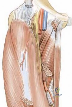 صورة توضيحية لـ القدم الجوفاء الحنفاء الروحاء (Equinocavovarus): دليل شامل للمرضى في اليمن والخليج العربي