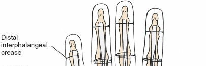 Illustration of flexor tendons volar - Dr. Mohammed Hutaif