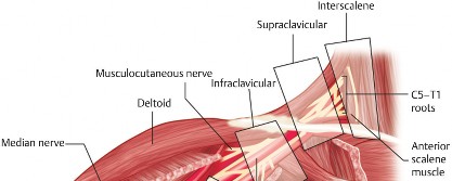 Perioperative Pain Management: Less Pain, Faster Shoulder Recovery