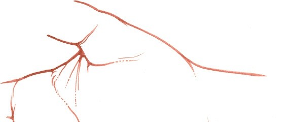 Illustration 85 for Essential Surgical Approaches: Uncover Every Aspect of the Wrist