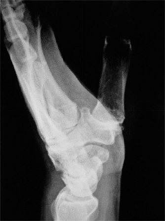 Illustration 8 for Unlock Wrist Diagnosis: Cases Guided by Figure Sunil Thirkannad