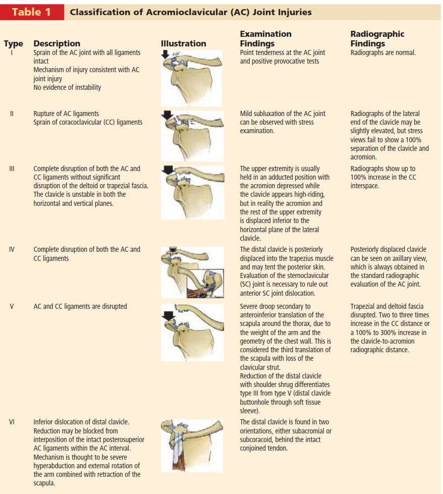 Is distal clavicle resection the fix for your AC joint pain?