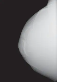 صورة توضيحية لـ استبدال مفصل الركبة الكلي للركبة الروحاء: تقنيات متقدمة وتجنب التحديات مع الأستاذ الدكتور محمد هطيف