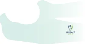 Illustration of radial head replacement - Dr. Mohammed Hutaif
