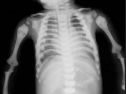 Pediatric Orthopaedic B Review | Dr Hutaif Pediatric Or -...