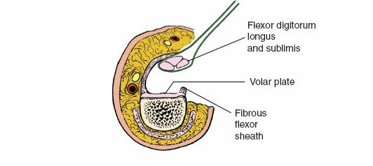 Illustration 157 for Essential Surgical Approaches: Uncover Every Aspect of the Wrist