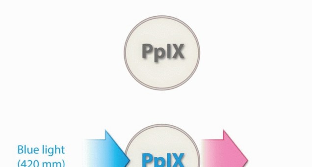 صورة لأشعة رنين مغناطيسي تظهر ورمًا في العظام، توضح أهمية التشخيص الدقيق