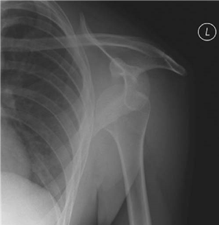 Illustration 17 for Ace Your FRCS: Key Questions in Trauma & Orthopaedics