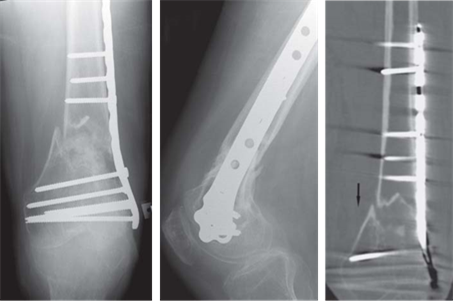 Illustration 8 for Pass Your Basic Sciences Viva: Key Anatomy & Pathology