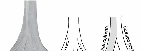 Distal Humerus Fractures: Understanding Causes, Anatomy & Epidemiology