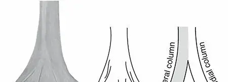 كسور عظم العضد السفلي: دليل شامل للتعافي مع الأستاذ الدكتور محمد هطيف