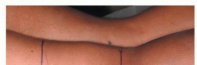 صورة توضيحية لجراح يقوم بعملية دقيقة