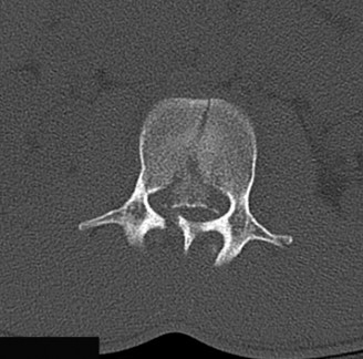 Illustration 42 for Master Orthopedic Spine Cases: Sharpen Your Diagnostic Skills