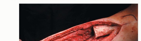 وصف طبي دقيق للمريض