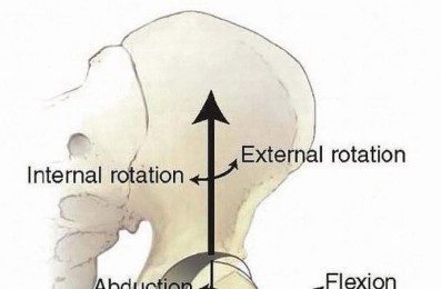 Restore Hip Health: Pelvic Osteotomy for Acetabular Dysplasia & CEA of Less