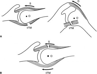Illustration 7 for Acad Orthop Surg Challenge: Diagnose Shoulder Pain Case 1