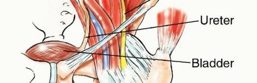 توضيح طبي: جراحة نقائل الحوض: حل شامل لآلام العظام واستعادة الحركة مع الأستاذ الدكتور محمد هطيف
