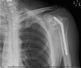 Illustration 3 for Solve Shoulder & Elbow Cases: When a Patient Presents to Clinic