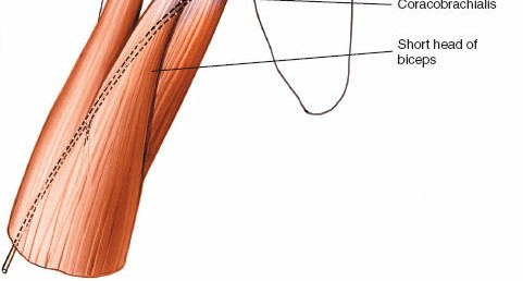 Illustration 28 for Essential Guide: Mastering Every Approach to the Shoulder