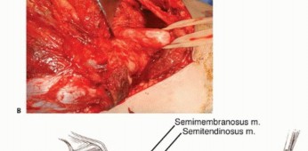 وصف طبي دقيق للمريض