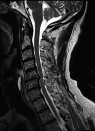 Illustration 33 for Master Orthopedic Spine Cases: Sharpen Your Diagnostic Skills