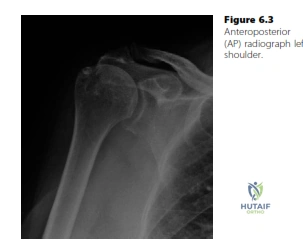 Comprehensive Orthopaedic & Spine Surgery Board Exam Review: ABOS Part I & AAOS OITE Questions | Part 21573