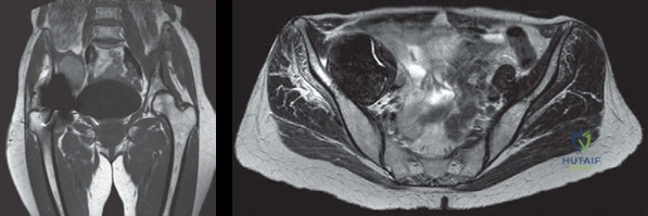 Illustration of structured hip oral examination - Dr. Mohammed Hutaif