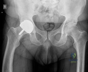 Illustration 1 for Structured Hip Oral Examination: Master This Complex Case