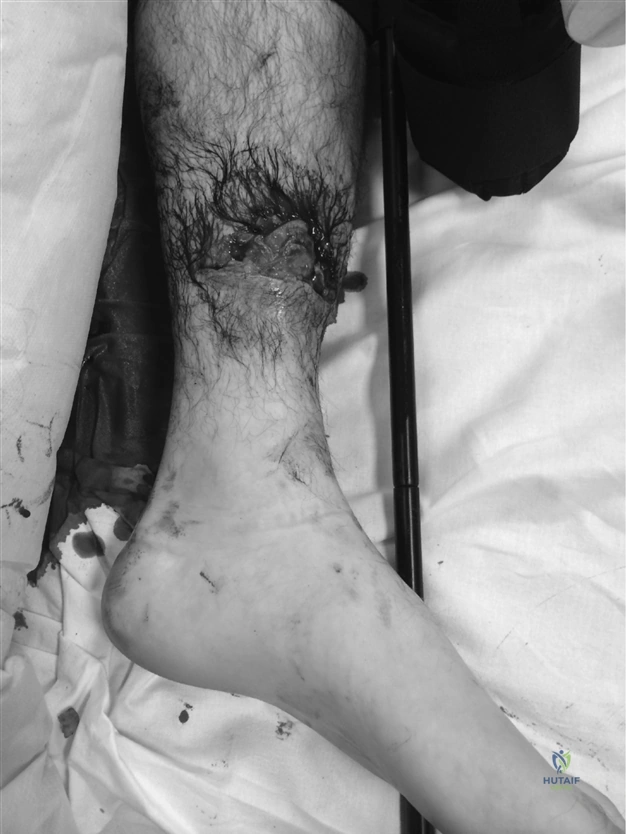 ABOS Part I & AAOS OITE Orthopaedic Surgery Exam Prep: Review Questions & Trauma Cases | Part 21576