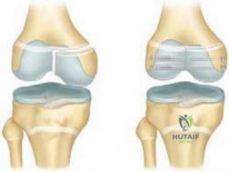ABOS Part I Orthopaedic Surgery Board Review: Paley's Principles & Deformity Correction | Part 22022