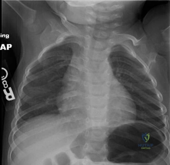 Illustration of patients with dmd - Dr. Mohammed Hutaif