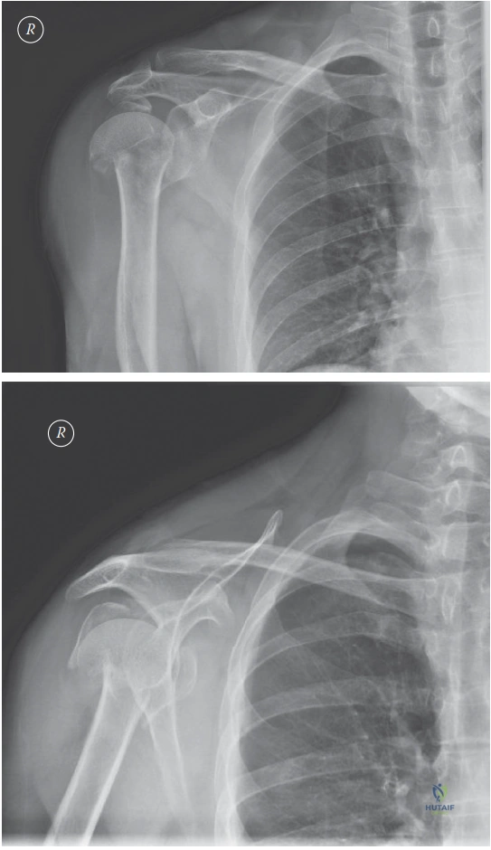 ABOS Part I & AAOS OITE Orthopedic Trauma & Hand Surgery Review MCQs | Part 22228