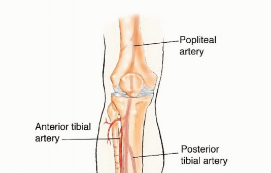Free Vascularized Fibular Grafts: Solving Complex Bone Defects