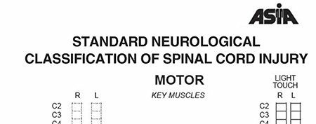 Axial Skeleton Fractures: Understanding Spinal Cord Injury Risk