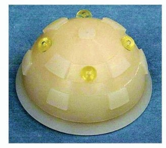 Cemented Total Hip: A Successful & Evidence-Based Solution