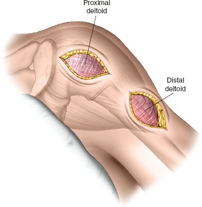 Illustration 113 for Essential Guide: Mastering Every Approach to the Shoulder