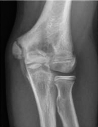 Illustration 2 for 18 Pediatric Cases: Single Sport Specialization Risks Unpacked