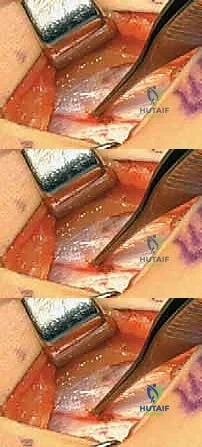 Clinical Image