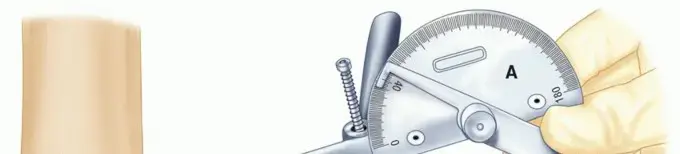 تثبيت مفصل الكوع (الإنصهار): الحل الأخير لآلام الكوع المستعصية واستعادة الوظيفة | الأستاذ الدكتور محمد هطيف