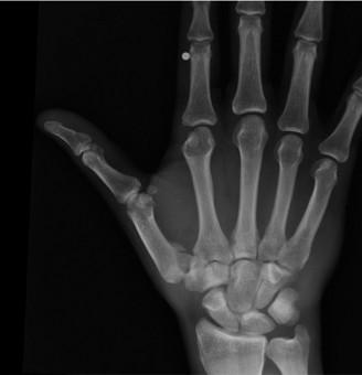 Illustration 5 for Unlock Wrist Diagnosis: Cases Guided by Figure Sunil Thirkannad