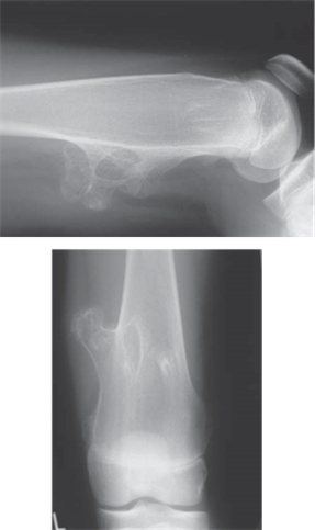 Illustration 32 for Ace FRCS Orthopaedics: Oxford University Press Adult Pathology Viva
