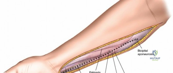 Clinical Image
