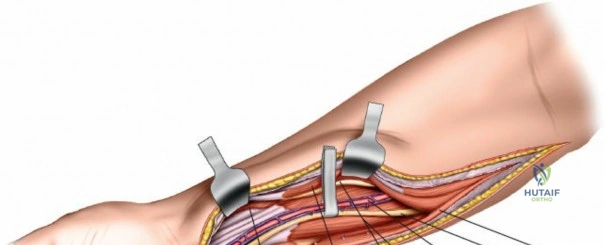 Clinical Image