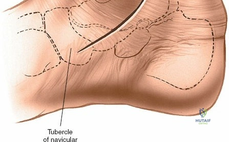 Clinical Image