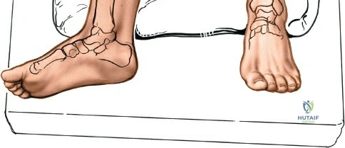 Clinical Image